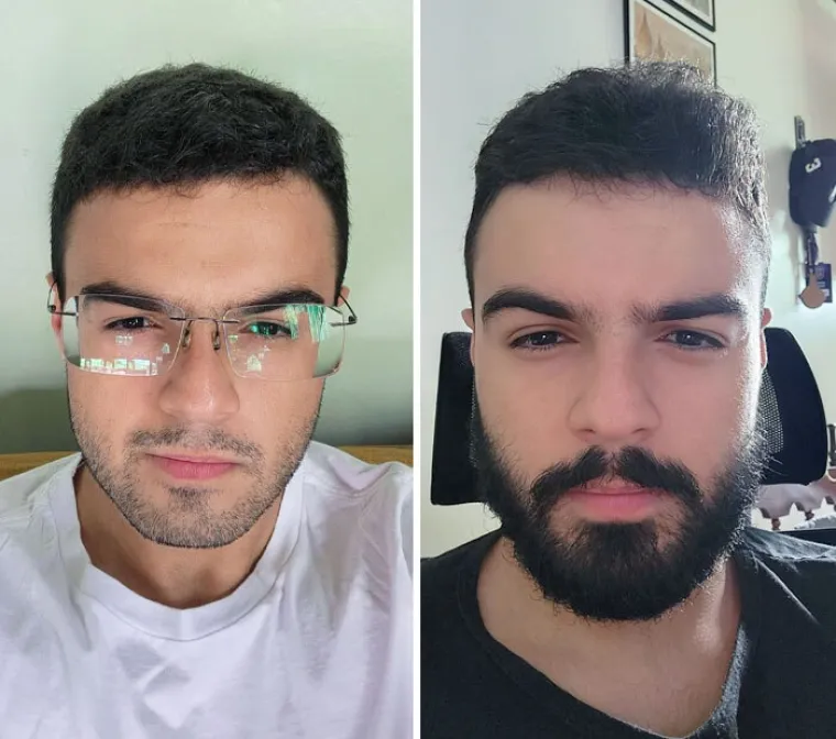 Jesu li brade mu&scaron;karcima &scaron;to i ženama &scaron;minka? Neki kada se obriju ne izgledaju kao iste osobe