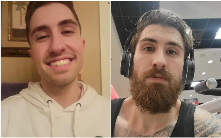 Jesu li brade mu&scaron;karcima &scaron;to i ženama &scaron;minka? Neki kada se obriju ne izgledaju kao iste osobe