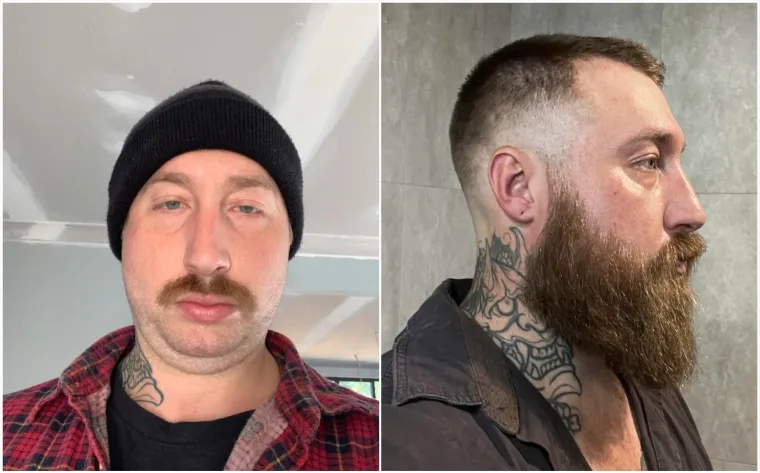 Jesu li brade mu&scaron;karcima &scaron;to i ženama &scaron;minka? Neki kada se obriju ne izgledaju kao iste osobe