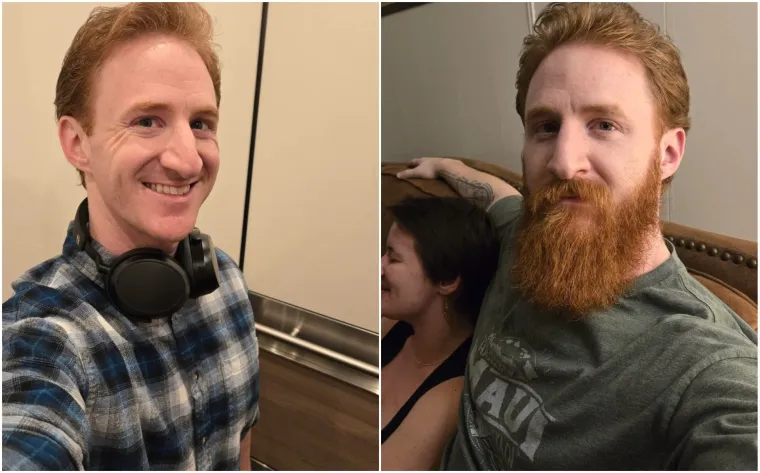 Jesu li brade mu&scaron;karcima &scaron;to i ženama &scaron;minka? Neki kada se obriju ne izgledaju kao iste osobe