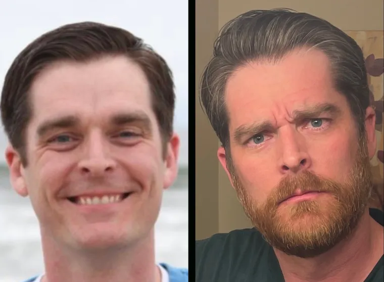 Jesu li brade mu&scaron;karcima &scaron;to i ženama &scaron;minka? Neki kada se obriju ne izgledaju kao iste osobe