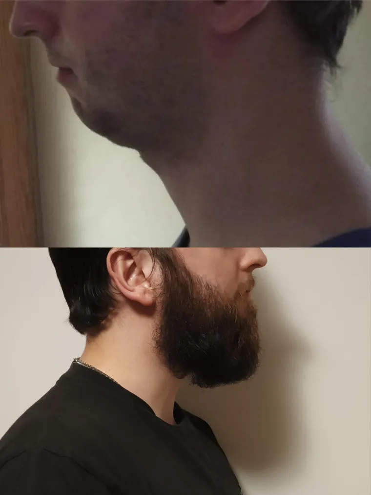 Jesu li brade mu&scaron;karcima &scaron;to i ženama &scaron;minka? Neki kada se obriju ne izgledaju kao iste osobe