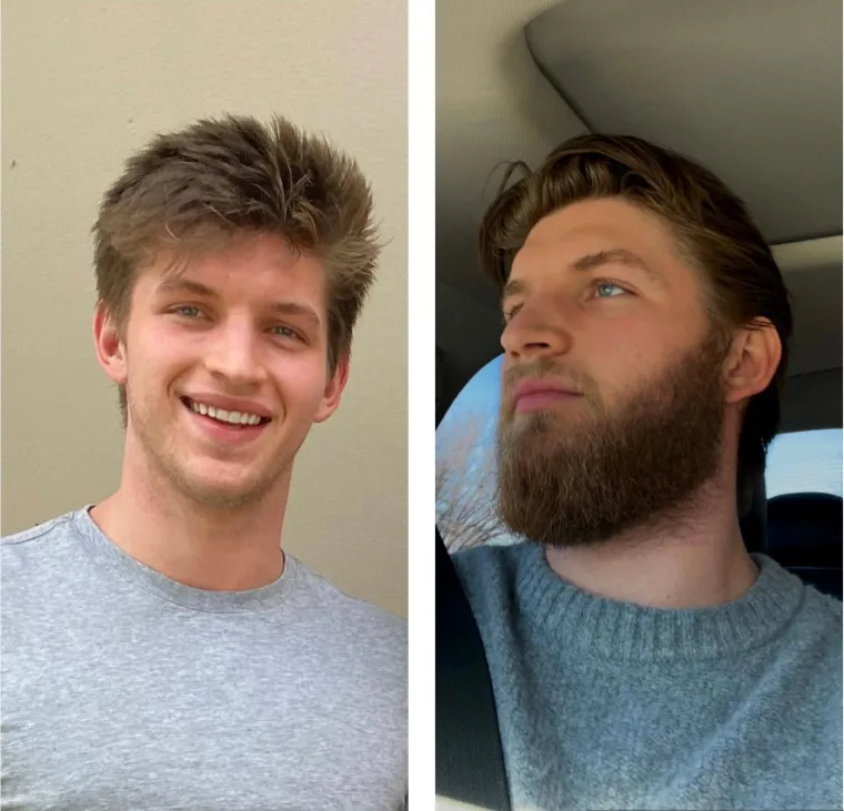 Jesu li brade mu&scaron;karcima &scaron;to i ženama &scaron;minka? Neki kada se obriju ne izgledaju kao iste osobe