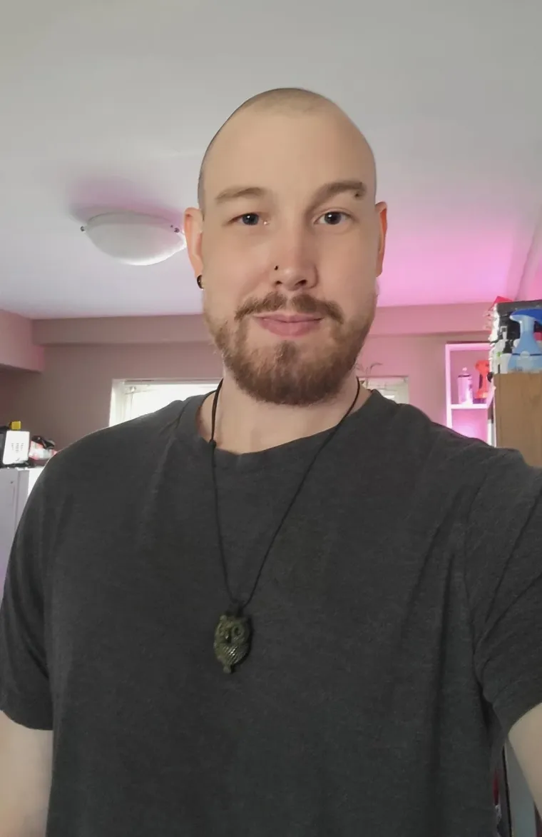 Ćelavite? Postoji divno mjesto na internetu gdje će vam tisuće ljudi pružiti podr&scaron;ku i utjehu