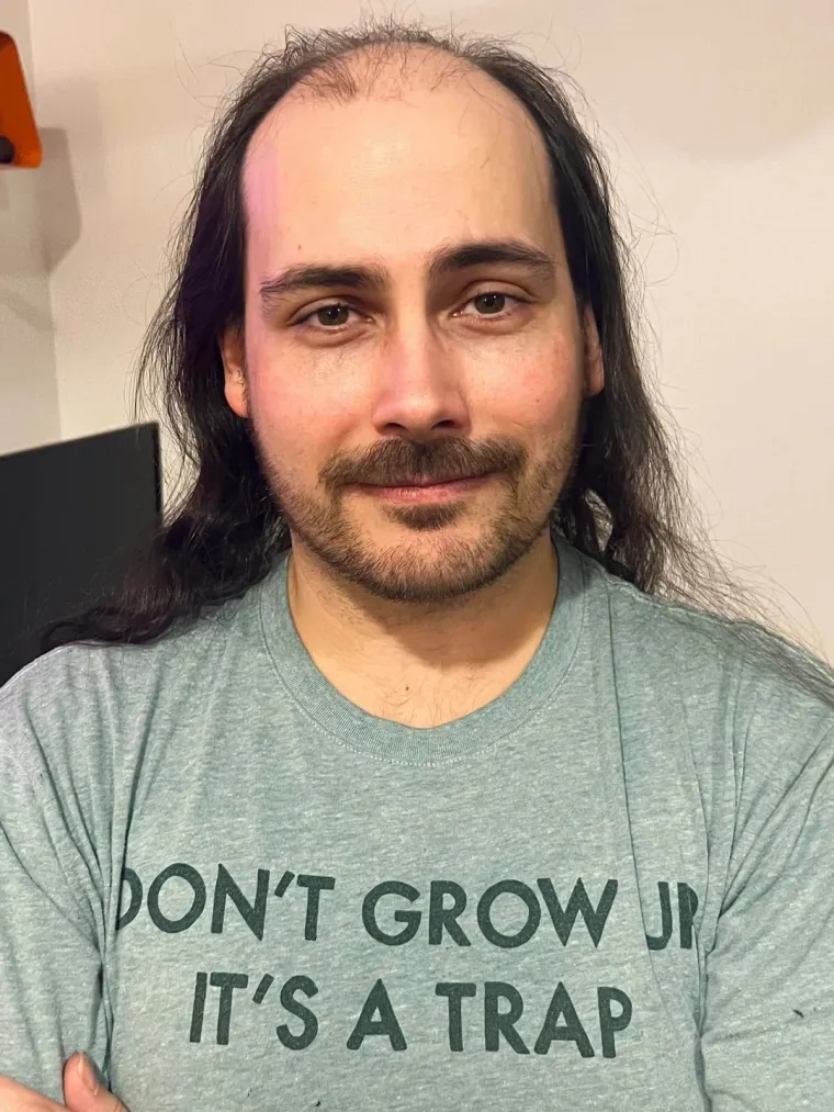 Ćelavite? Postoji divno mjesto na internetu gdje će vam tisuće ljudi pružiti podr&scaron;ku i utjehu