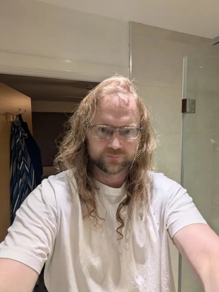 Ćelavite? Postoji divno mjesto na internetu gdje će vam tisuće ljudi pružiti podr&scaron;ku i utjehu