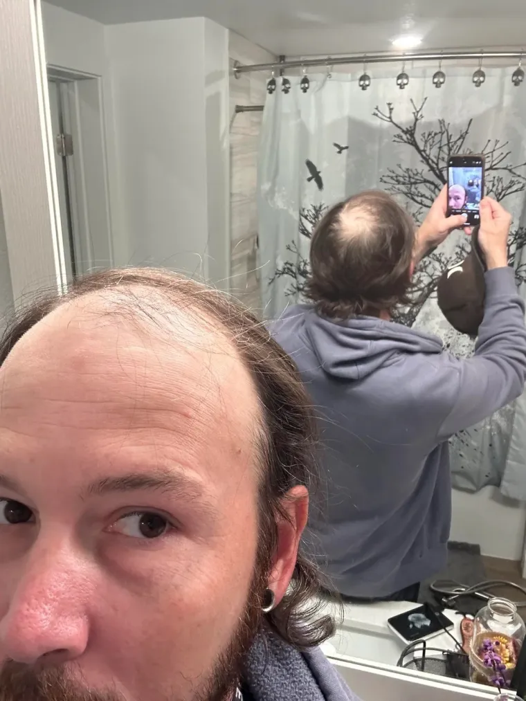 Ćelavite? Postoji divno mjesto na internetu gdje će vam tisuće ljudi pružiti podr&scaron;ku i utjehu