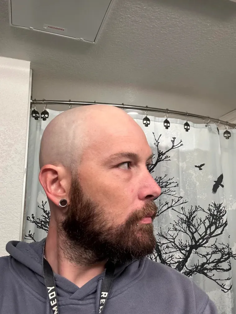 Ćelavite? Postoji divno mjesto na internetu gdje će vam tisuće ljudi pružiti podr&scaron;ku i utjehu