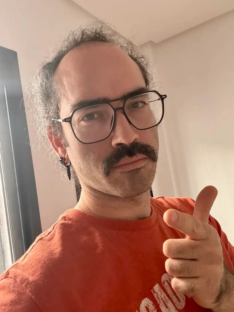 Ćelavite? Postoji divno mjesto na internetu gdje će vam tisuće ljudi pružiti podr&scaron;ku i utjehu