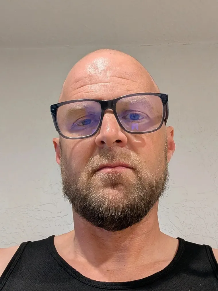 Ćelavite? Postoji divno mjesto na internetu gdje će vam tisuće ljudi pružiti podr&scaron;ku i utjehu