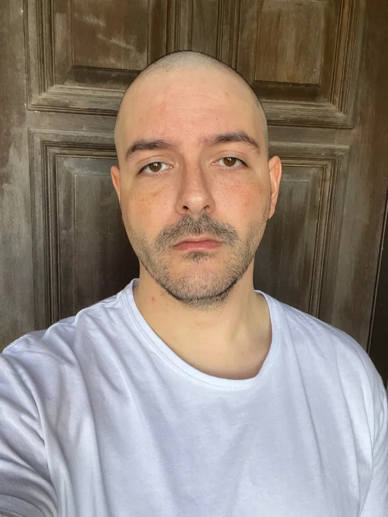 Ćelavite? Postoji divno mjesto na internetu gdje će vam tisuće ljudi pružiti podr&scaron;ku i utjehu