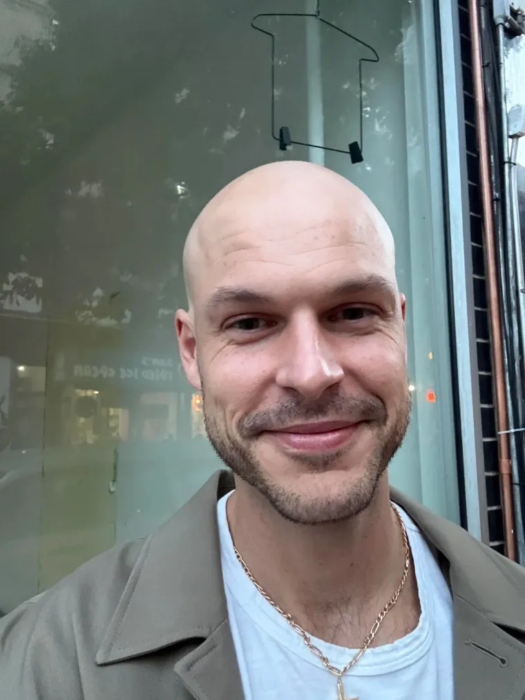 Ćelavite? Postoji divno mjesto na internetu gdje će vam tisuće ljudi pružiti podr&scaron;ku i utjehu