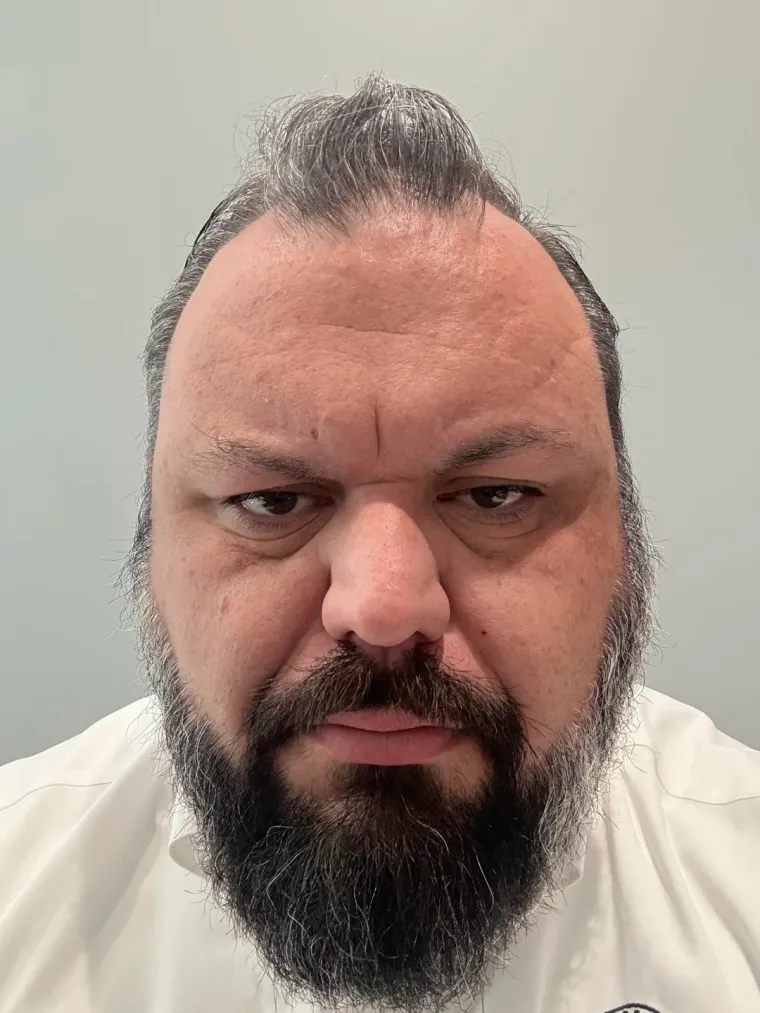 Ćelavite? Postoji divno mjesto na internetu gdje će vam tisuće ljudi pružiti podr&scaron;ku i utjehu