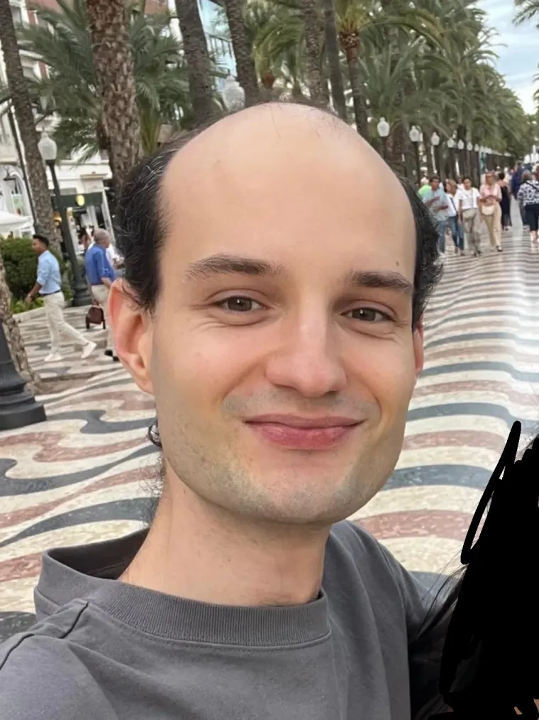 Ćelavite? Postoji divno mjesto na internetu gdje će vam tisuće ljudi pružiti podr&scaron;ku i utjehu