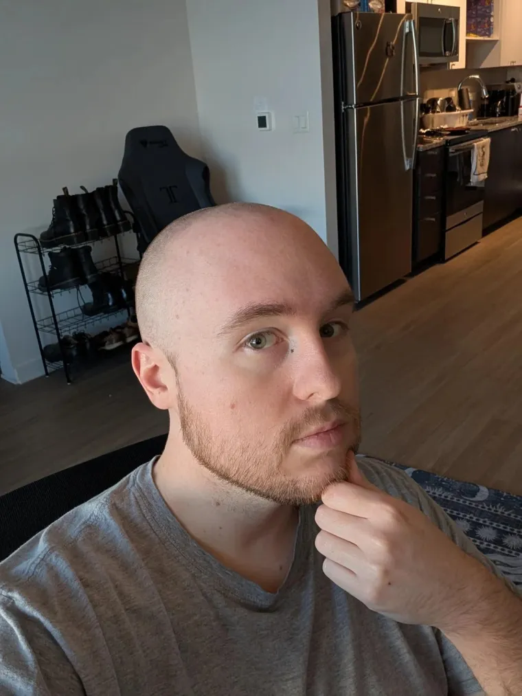 Ćelavite? Postoji divno mjesto na internetu gdje će vam tisuće ljudi pružiti podr&scaron;ku i utjehu