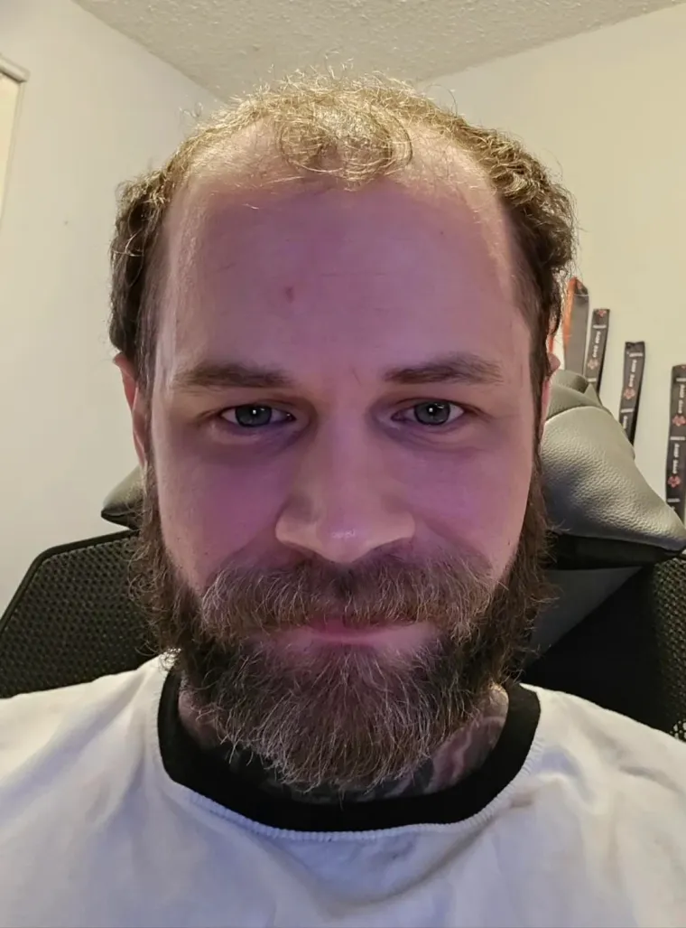 Ćelavite? Postoji divno mjesto na internetu gdje će vam tisuće ljudi pružiti podr&scaron;ku i utjehu