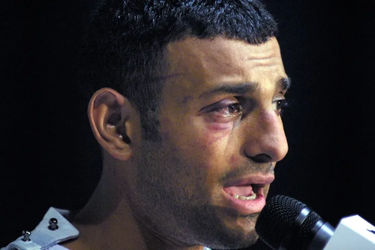 Stres pojeo zaboravljenu legendu koja sad ne liči na sebe: Dogodilo mu se ne&scaron;to &scaron;okantno