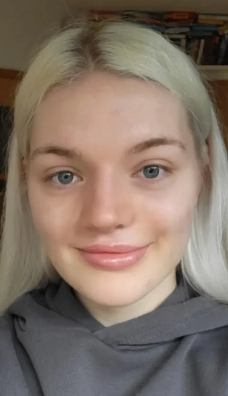 Podvrgnuli se estetskim zahvatima, pa od sebe napravili čudo: Neki su danas neprepoznatljivi