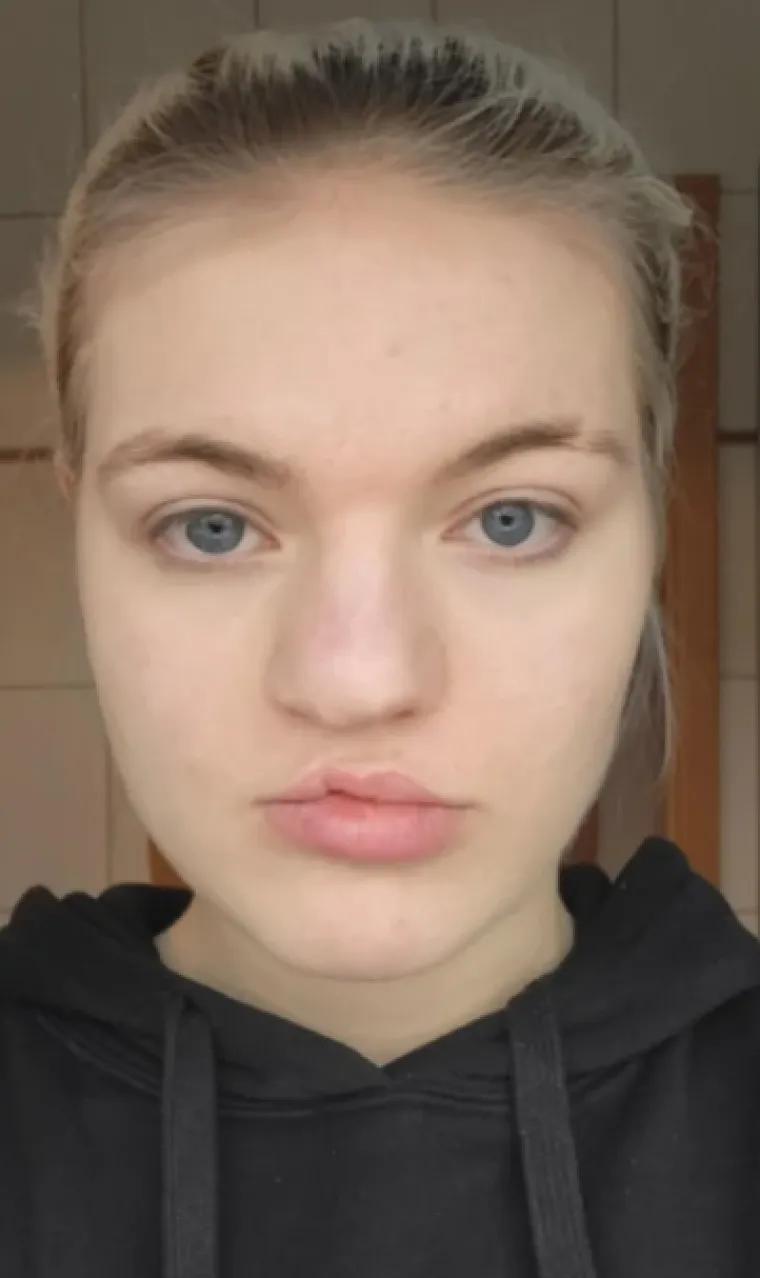 Podvrgnuli se estetskim zahvatima, pa od sebe napravili čudo: Neki su danas neprepoznatljivi