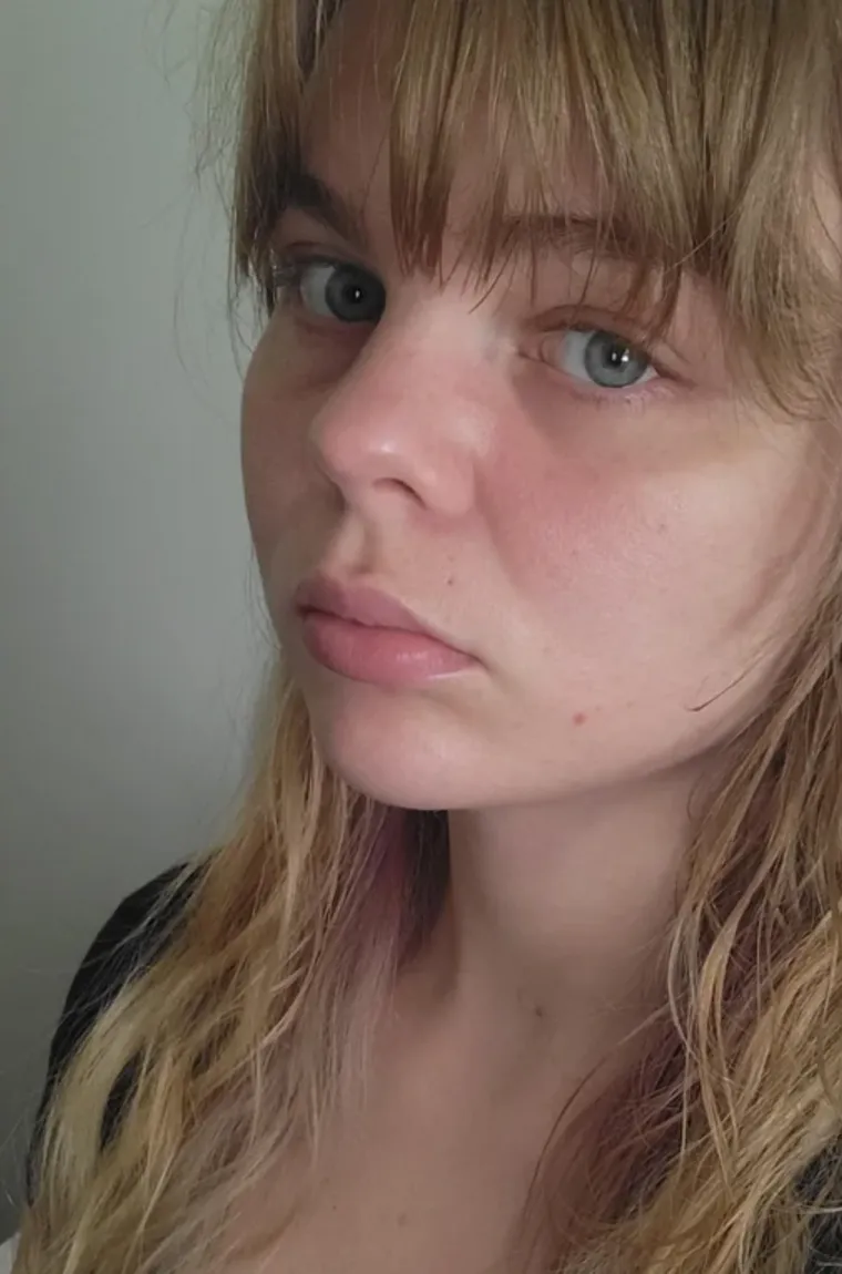 Podvrgnuli se estetskim zahvatima, pa od sebe napravili čudo: Neki su danas neprepoznatljivi