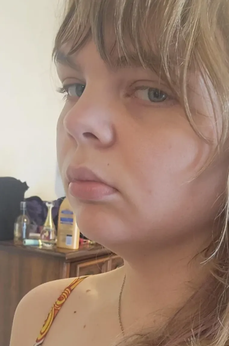 Podvrgnuli se estetskim zahvatima, pa od sebe napravili čudo: Neki su danas neprepoznatljivi