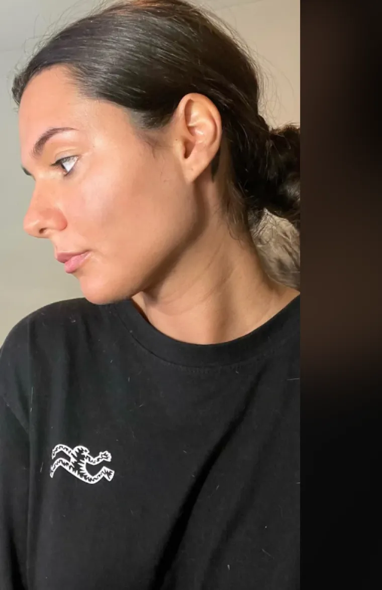 Podvrgnuli se estetskim zahvatima, pa od sebe napravili čudo: Neki su danas neprepoznatljivi