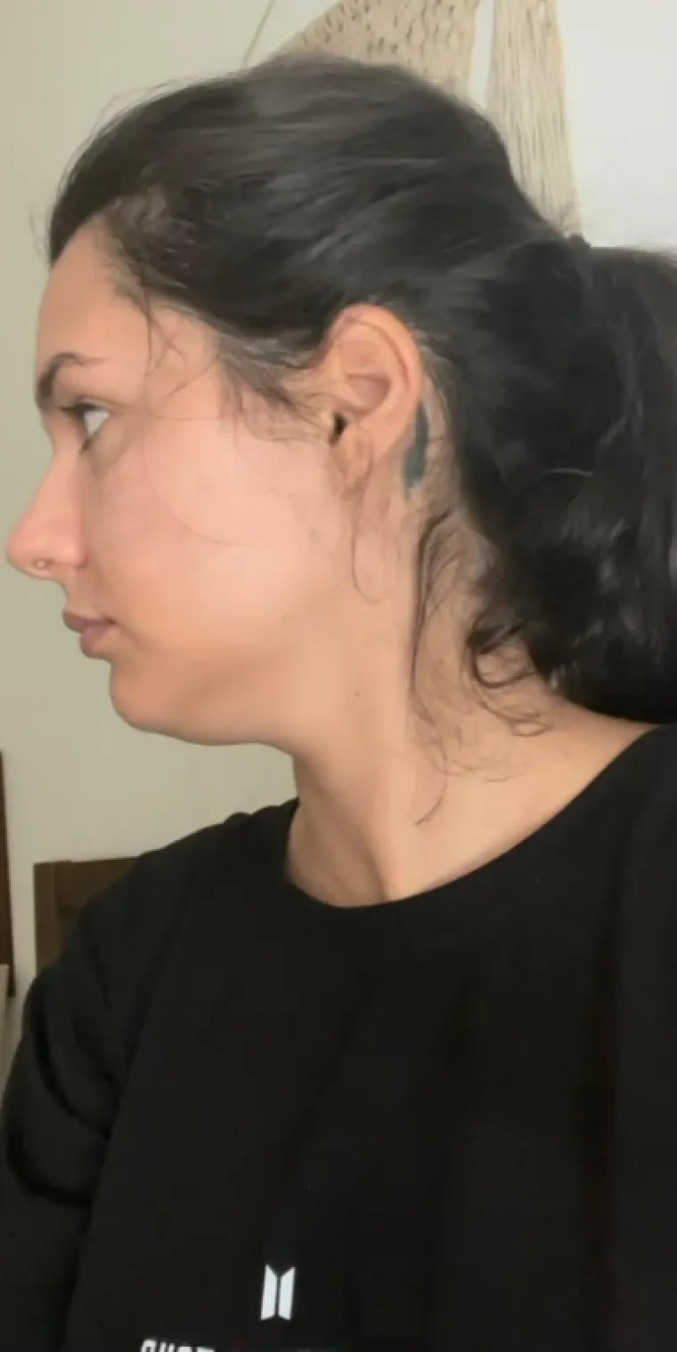 Podvrgnuli se estetskim zahvatima, pa od sebe napravili čudo: Neki su danas neprepoznatljivi