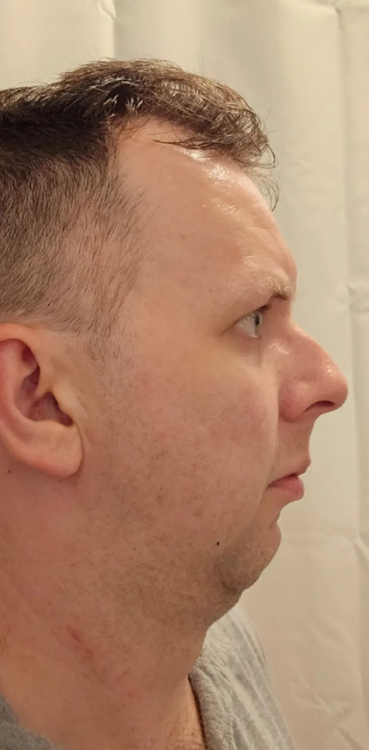 Podvrgnuli se estetskim zahvatima, pa od sebe napravili čudo: Neki su danas neprepoznatljivi