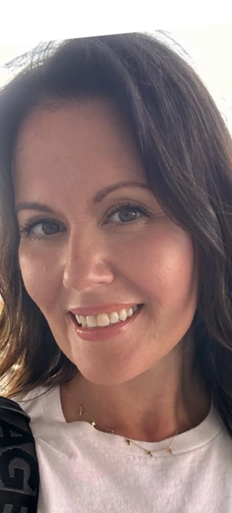 Podvrgnuli se estetskim zahvatima, pa od sebe napravili čudo: Neki su danas neprepoznatljivi