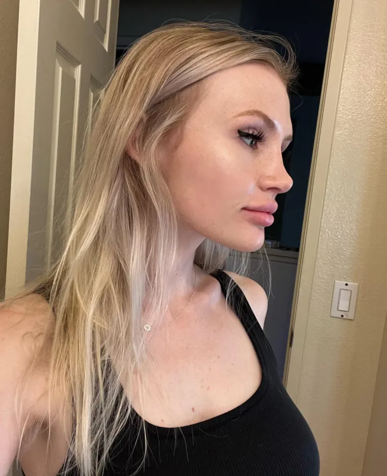 Podvrgnuli se estetskim zahvatima, pa od sebe napravili čudo: Neki su danas neprepoznatljivi