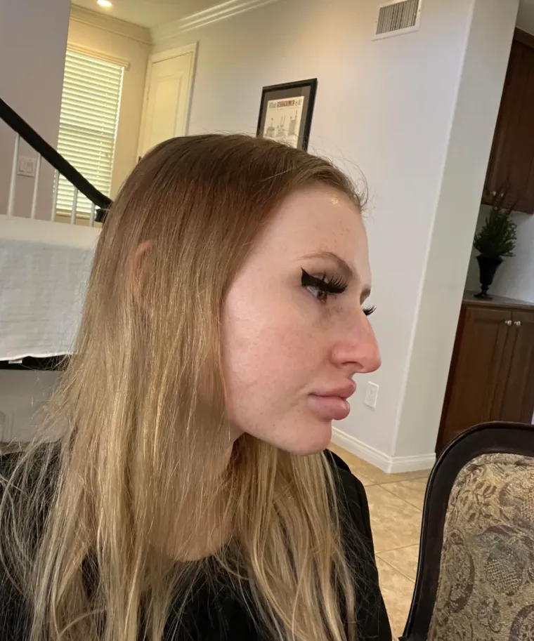 Podvrgnuli se estetskim zahvatima, pa od sebe napravili čudo: Neki su danas neprepoznatljivi