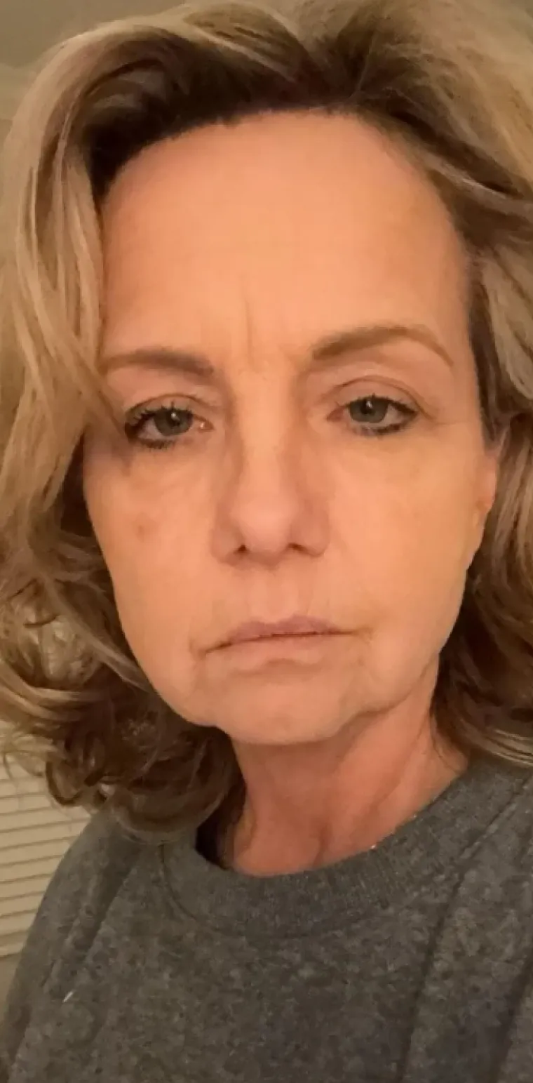 Podvrgnuli se estetskim zahvatima, pa od sebe napravili čudo: Neki su danas neprepoznatljivi