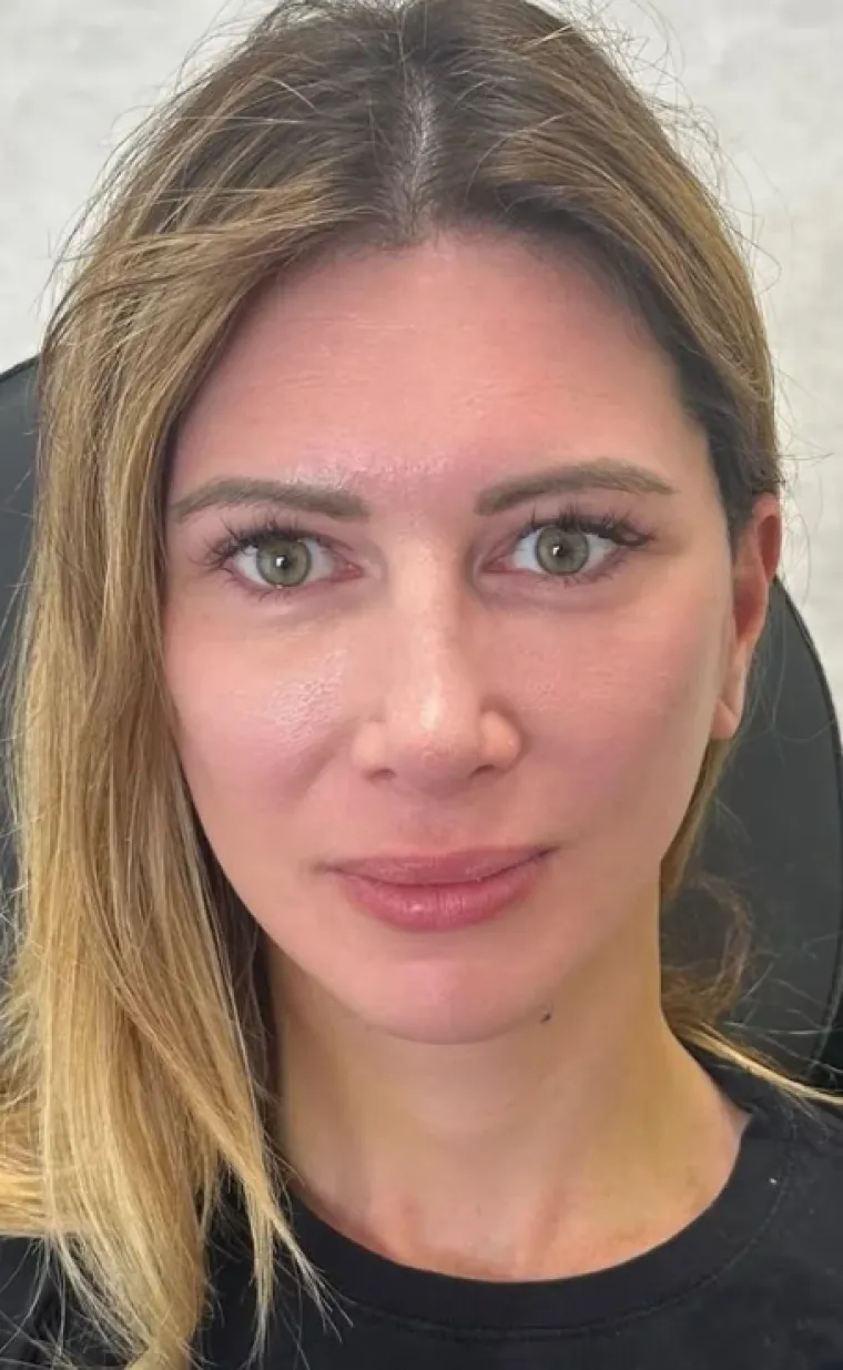 Podvrgnuli se estetskim zahvatima, pa od sebe napravili čudo: Neki su danas neprepoznatljivi