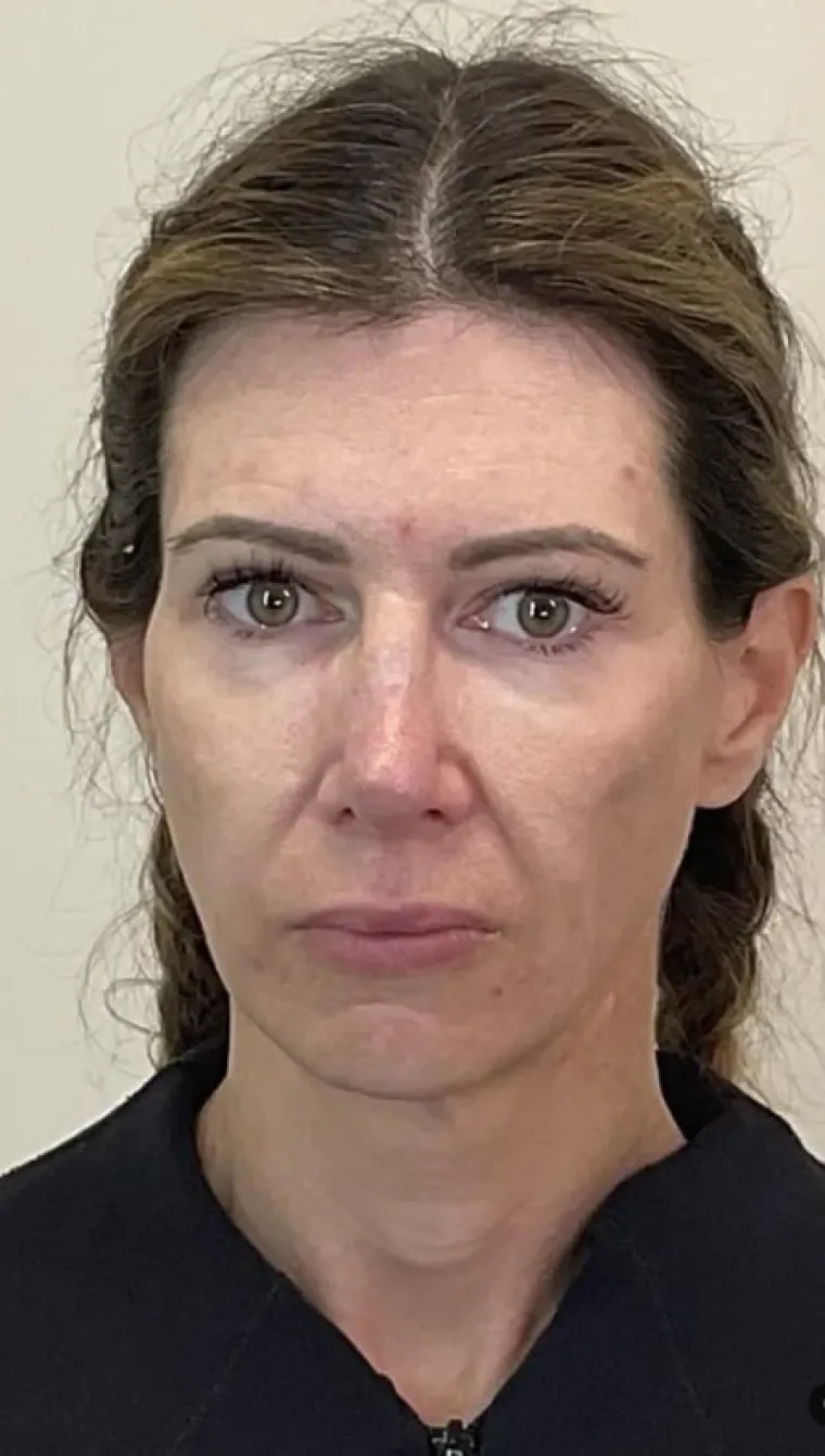 Podvrgnuli se estetskim zahvatima, pa od sebe napravili čudo: Neki su danas neprepoznatljivi