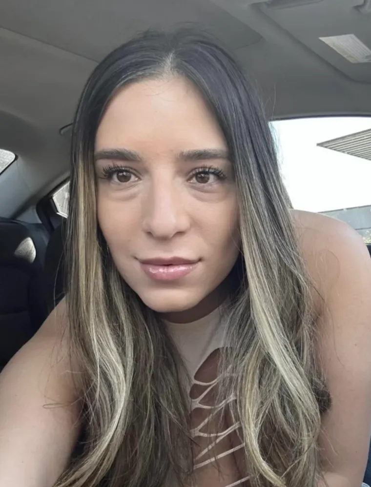 Podvrgnuli se estetskim zahvatima, pa od sebe napravili čudo: Neki su danas neprepoznatljivi