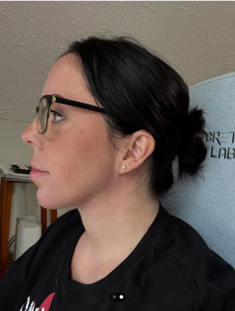 Podvrgnuli se estetskim zahvatima, pa od sebe napravili čudo: Neki su danas neprepoznatljivi