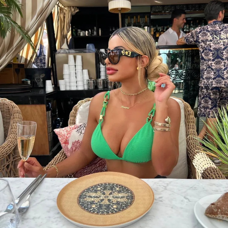 Bila je ideal ljepote, a onda je oti&scaron;la pod nož: Ovako danas izgleda biv&scaron;i model