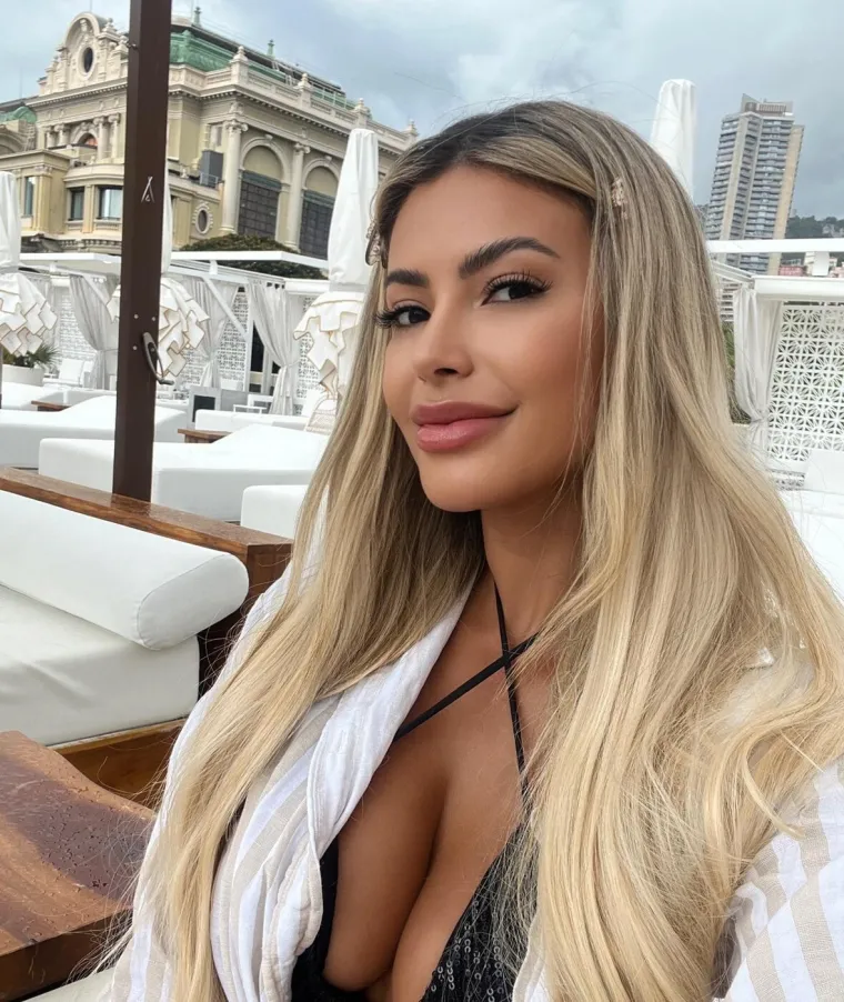 Bila je ideal ljepote, a onda je oti&scaron;la pod nož: Ovako danas izgleda biv&scaron;i model