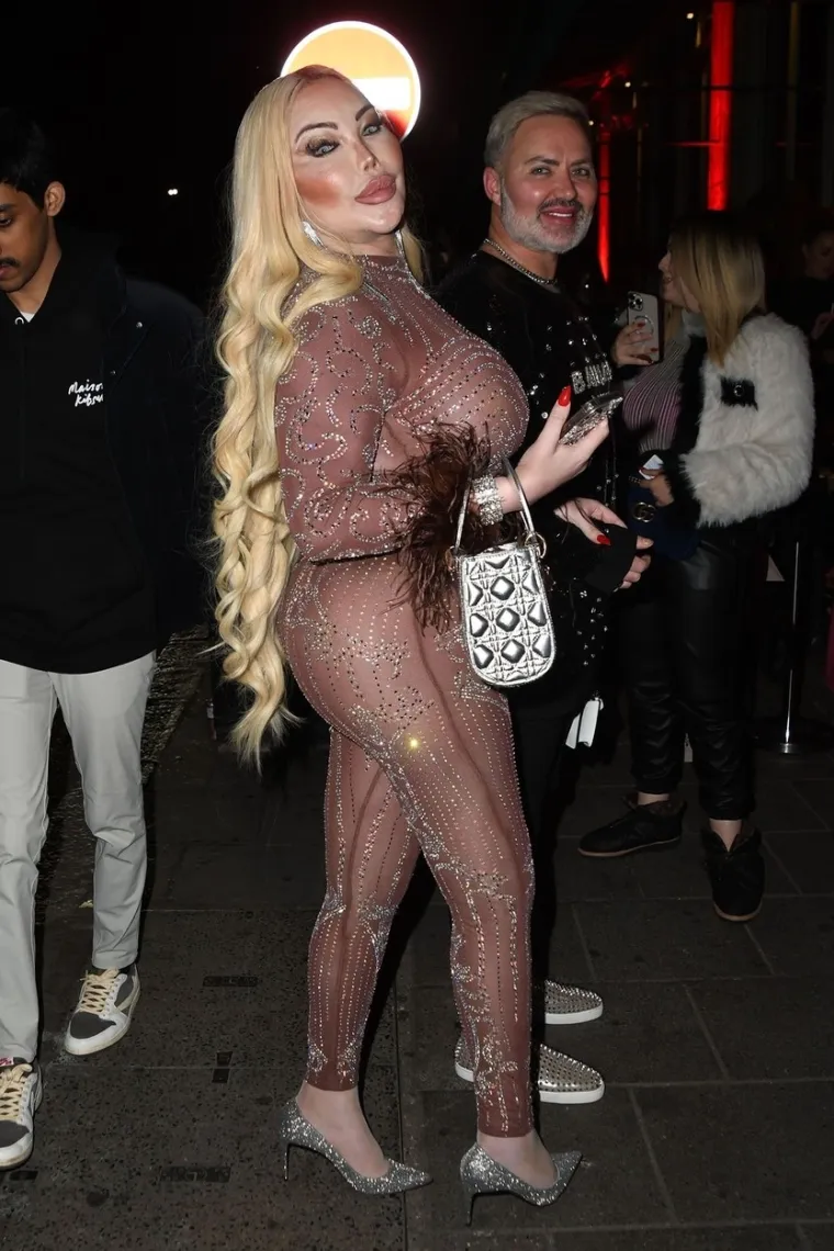 Nevjerojatna transformacija: Sad je bila uzbuđena, a pogledajte kako je prije izgledala