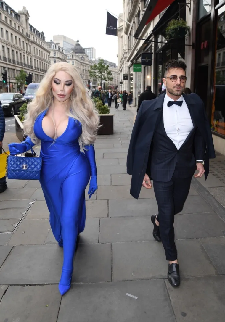 Nevjerojatna transformacija: Sad je bila uzbuđena, a pogledajte kako je prije izgledala