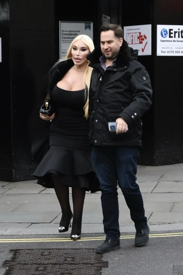 Nevjerojatna transformacija: Sad je bila uzbuđena, a pogledajte kako je prije izgledala