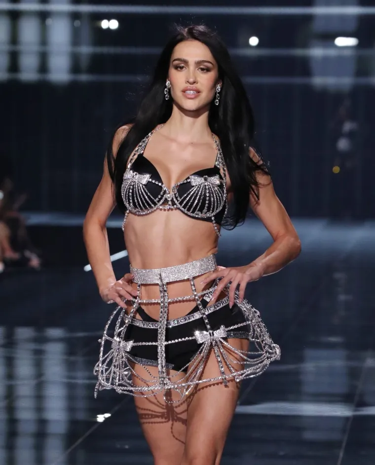 Tajne modela: Manekenka priznala je koji su joj estetski zahvati uni&scaron;tili život