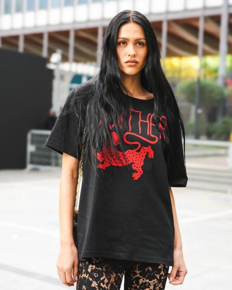 Tajne modela: Manekenka priznala je koji su joj estetski zahvati uni&scaron;tili život