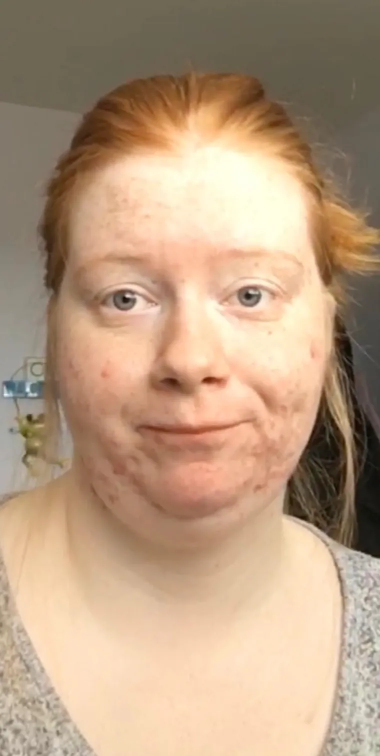 Nekad su se skrivale, danas ponosno pokazuju sebe: Nevjerojatno u kakve su se ljepotice pretvorile