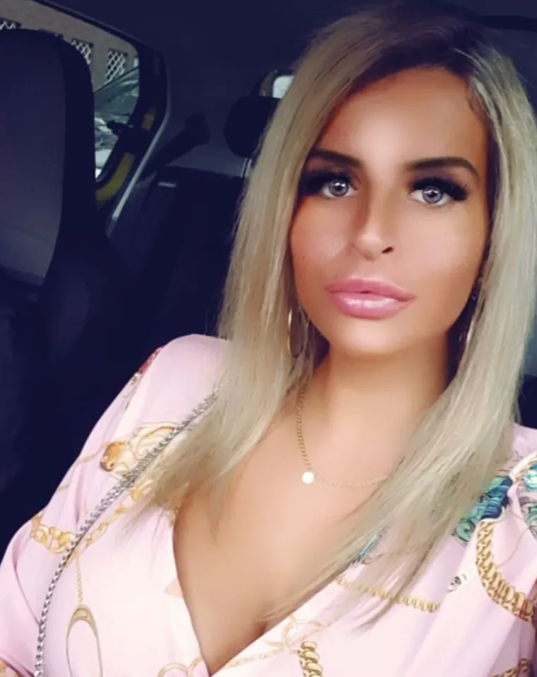 Bila je prava ljepotica, sada je prepuna tetovaža: Čak je odrezala i nos i čuva ga u staklenki