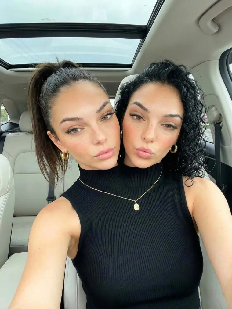 Svijet raspametile prelijepe sestre koje dijele jedno tijelo, no priča ima i jedno veliko 'ali'