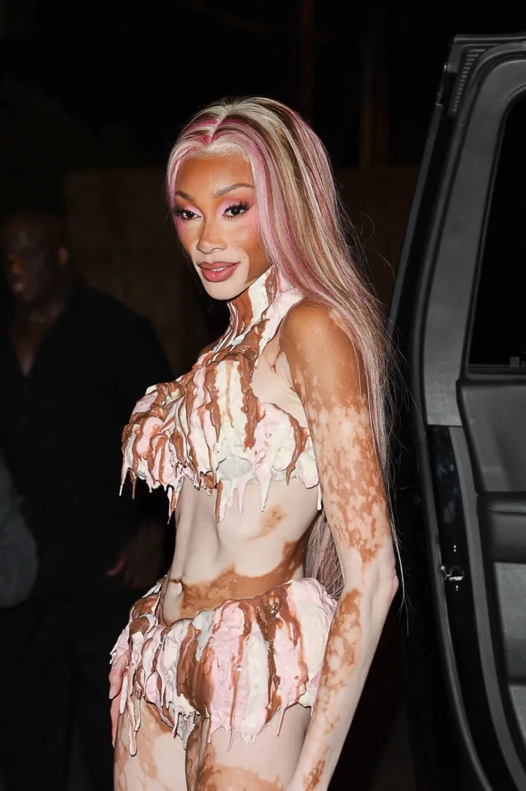 O njoj uvijek pričaju svi! Winnie Harlow zasjala na crvenom tepihu u neodoljivom izdanju koje oduzima dah