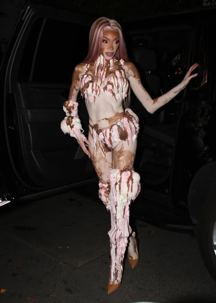 O njoj uvijek pričaju svi! Winnie Harlow zasjala na crvenom tepihu u neodoljivom izdanju koje oduzima dah