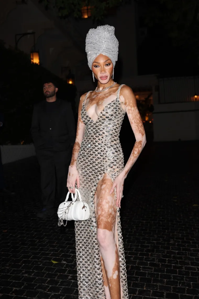 O njoj uvijek pričaju svi! Winnie Harlow zasjala na crvenom tepihu u neodoljivom izdanju koje oduzima dah