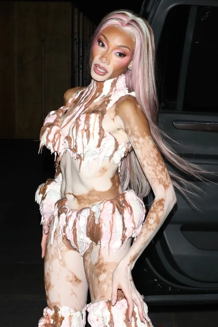 O njoj uvijek pričaju svi! Winnie Harlow zasjala na crvenom tepihu u neodoljivom izdanju koje oduzima dah